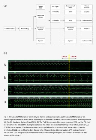 迈瑞协和最新研究成果解决不间断按压状态识别技术难题