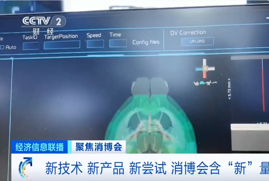 打破进口依赖！国产脑机接口芯片实现新突破！相关概念股盘中异动拉升  第4张