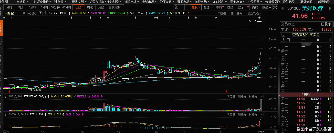 脑机接口二级市场“狂欢”,概念股“含金量”几何 第1张 脑机接口二级市场“狂欢”,概念股“含金量”几何 第1张