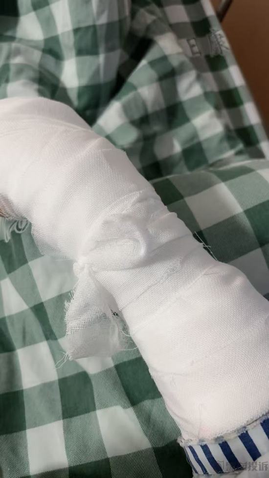 3月黑猫投诉酒店民宿领域红黑榜：维也纳酒店保洁留泡沫致客骨折  第3张